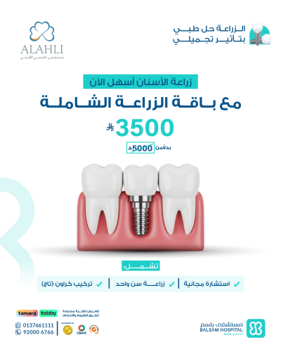 عرض زراعة الأسنان